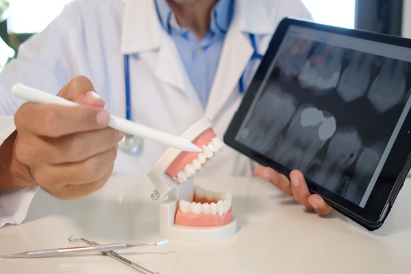 When Is Wisdom Tooth Extraction Recommended?